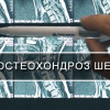 Межреберная невралгия