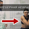 Остеохондроз