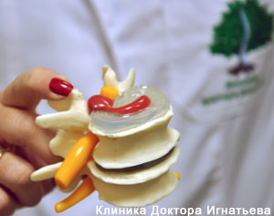 Вертебролог Киев